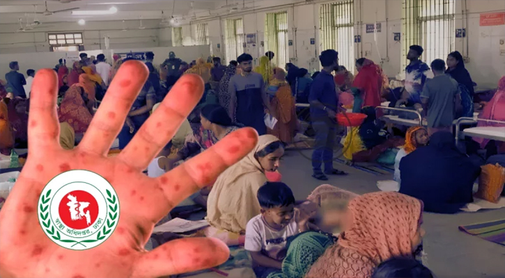 ২৪ ঘণ্টায় হাম সন্দেহে ৬ জনের মৃত্যু