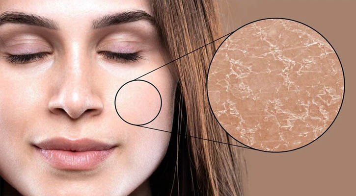 রোজায় ত্বক শুষ্ক হয়ে যাচ্ছে?