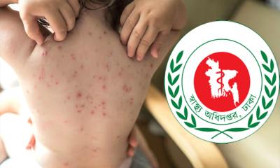 হাম উপসর্গে আরো ৭ শিশুর মৃত্যু