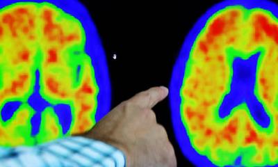 নিয়মিত চা–কফি পান করলে কমতে পারে ডিমেনশিয়ার ঝুঁকি