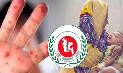 হাম ও হামের উপসর্গে মৃত্যু ৬০০ ছাড়াল