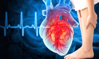 র্টের ঝুঁকি বোঝা যাবে পা দেখেই?