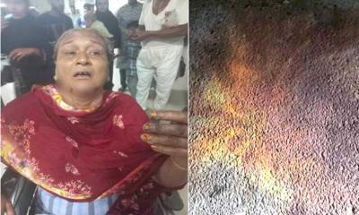 অটোরিকশায় ‘পেট্রোল বোমা’ নিক্ষেপ, ২ নারী দগ্ধ