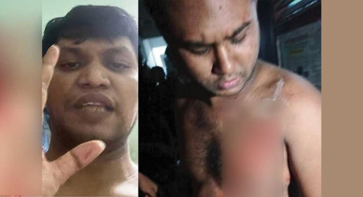 রুমমেটকে ছুরিকাঘাতের অভিযোগে ডাকসু ভিপি প্রার্থীকে পুলিশে সোপর্দ