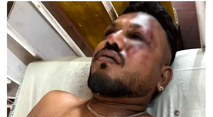 বিধ্বস্ত বিমান থেকে এক যাত্রীকে জীবিত উদ্ধার