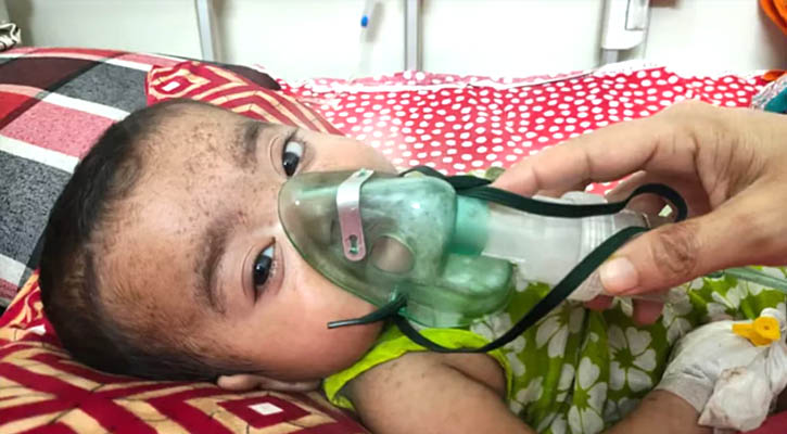 ময়মনসিংহ মেডিকেলে হামের লক্ষণ নিয়ে আরও ২৪ শিশু ভর্তি