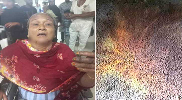 অটোরিকশায় ‘পেট্রোল বোমা’ নিক্ষেপ, ২ নারী দগ্ধ