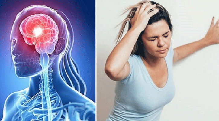 স্ট্রোকের ঝুঁকি এড়াতে  ৫ সতর্কতা