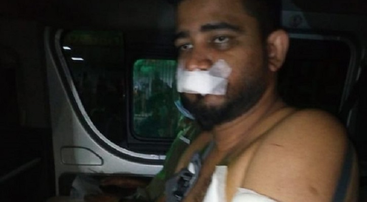 দুর্বৃত্তদের হামলায় ছাত্রলীগ নেতা আহত