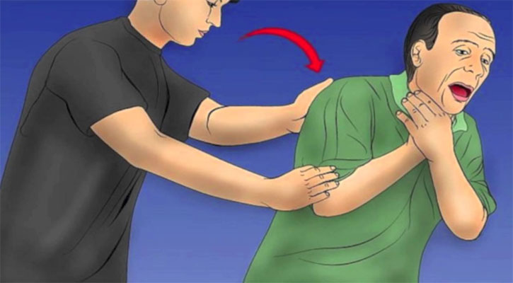 গলায় খাবার আটকে গেলে কী করবেন?