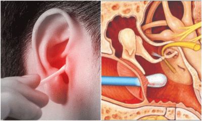কান খোঁচালে কী হয়