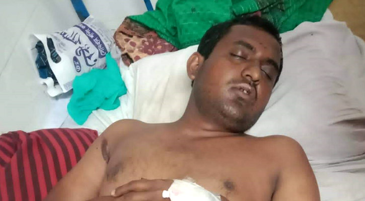 চুরির অপবাদে প্রতিবন্ধীর দাঁত ও নখ তুলে দেওয়ার অভিযোগ