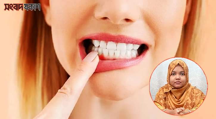 মাড়ি থেকে দাঁত আলগা হলে কী করবেন?